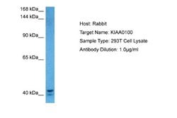 K0100 Rabbit anti-Human, Polyclonal, Novus Biologicals 0.1 mL | Buy Online | Novus Biologicals | Fisher Scientific